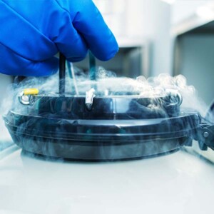 EBO_Automatic-Cryo-Storage-600