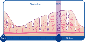 WOI Diagram_2-03