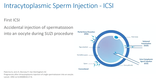 intracytoplasmic sperm injection icsi