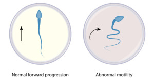 Sperm motility