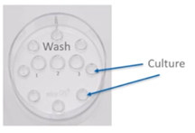 wash and culture